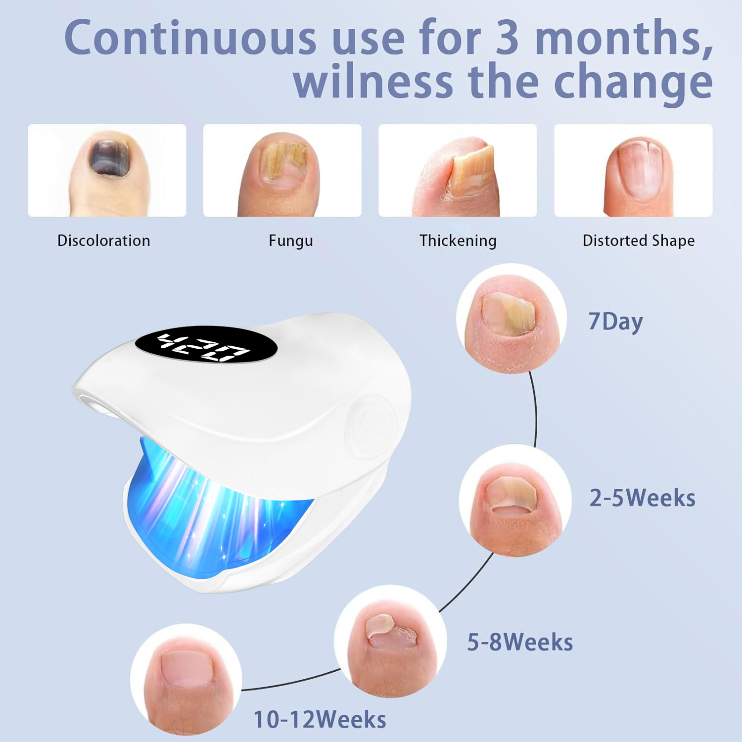 Nail Fungus Laser Device 500NM - огляд і ціна Galvanic Skin Sensor
